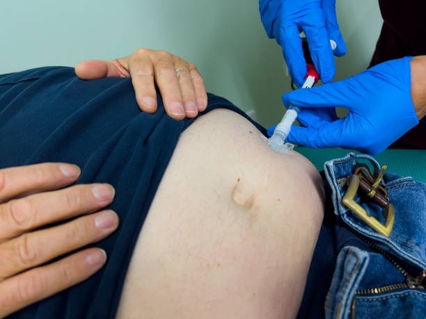 Testosterone Treatment for Energy, Strength & Vitality